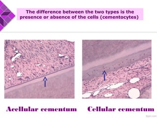 Acellular cementum Cellular cementum
The difference between the two types is the
presence or absence of the cells (cementocytes)
 