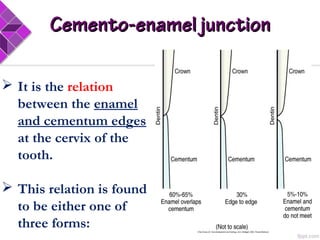 Cemento-enamel junctionCemento-enamel junction
 It is the relation
between the enamel
and cementum edges
at the cervix of the
tooth.
 This relation is found
to be either one of
three forms:
 