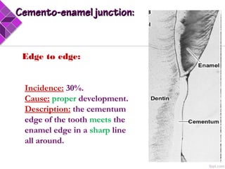 Edge to edge:
Incidence: 30%.
Cause: proper development.
Description: the cementum
edge of the tooth meets the
enamel edge in a sharp line
all around.
 
Cemento-enamel junction:Cemento-enamel junction:
 