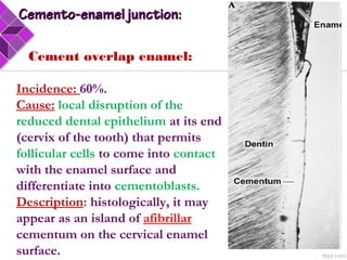 Cement overlap enamel:
Incidence: 60%.
Cause: local disruption of the
reduced dental epithelium at its end
(cervix of the tooth) that permits
follicular cells to come into contact
with the enamel surface and
differentiate into cementoblasts.
Description: histologically, it may
appear as an island of afibrillar
cementum on the cervical enamel
surface.
Cemento-enamel junction:Cemento-enamel junction:
 