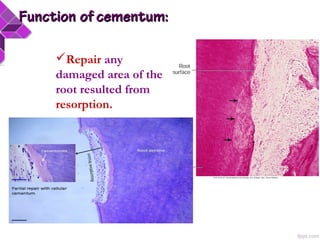 FunctionFunction of cementum:of cementum:
Repair any
damaged area of the
root resulted from
resorption.
 