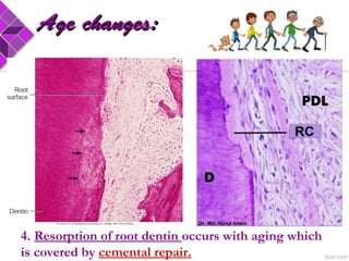 4. Resorption of root dentin occurs with aging which
is covered by cemental repair.
Age changes:Age changes:
 
