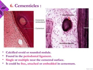 • Calcified ovoid or rounded nodule.
• Found in the periodontal ligament.
• Single or multiple near the cemental surface.
• It could be free, attached or embedded in cementum.
6. Cementicles :
Periodontal ligament
Cementum
Bone
Free Cementicles
 