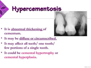 HypercementosisHypercementosis
• It is abnormal thickening of
cementum.
• It may be diffuse or circumscribed.
• It may affect all teeth/ one tooth/
few portions of a single tooth.
• It could be cemental hypertrophy or
cemental hyperplasia.
 
