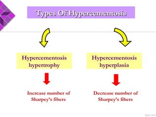 Hypercementosis
hyperplasia
Hypercementosis
hypertrophy
Increase number of
Sharpey’s fibers
Decrease number of
Sharpey’s fibers
Types Of HypercementosisTypes Of Hypercementosis
 
