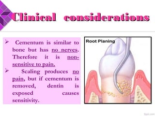  Cementum is similar to
bone but has no nerves.
Therefore it is non-
sensitive to pain.
 Scaling produces no
pain, but if cementum is
removed, dentin is
exposed causes
sensitivity.
Clinical considerationsClinical considerations
 