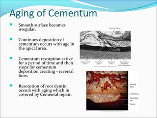 Cementum | PPT