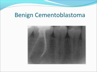 Cementum | PPT