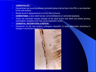 tooth cementum tooth physiology form and | PPT