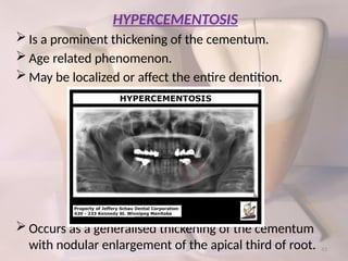 CEMENTUM – ULTRA STRUCTURE & FUNCTIONS.pptx