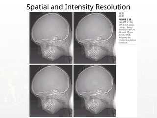 Spatial and Intensity Resolution
 