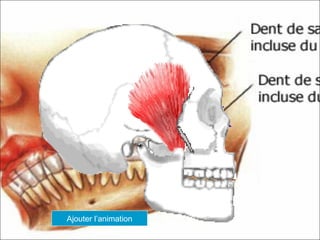 Ajouter l’animation
 