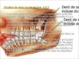 4.2.34.2.3..Position de repos ou de posturePosition de repos ou de posture::
 C’est une position d’équilibre neuro-musculaire entre lesC’est une position d’équilibre neuro-musculaire entre les
muscles d’ouverture et de fermeture dans laquelle il n’y amuscles d’ouverture et de fermeture dans laquelle il n’y a
aucun contact entre les dents antagonistes.aucun contact entre les dents antagonistes.
 La distance entre la position de repos et la position d’ICMLa distance entre la position de repos et la position d’ICM
est appelée : distance inter occlusale ou espace libre d’inest appelée : distance inter occlusale ou espace libre d’in
occlusion.occlusion.
 C’est l’espace séparant les surfaces occlusalesC’est l’espace séparant les surfaces occlusales
supérieures et inférieures quand la mandibule est dans sasupérieures et inférieures quand la mandibule est dans sa
position physiologique de repos.position physiologique de repos.
 Cette distance peut être calculé entre gnathion et le pointCette distance peut être calculé entre gnathion et le point
sous nasal lorsque la mandibule est en position de repossous nasal lorsque la mandibule est en position de repos
(DVR) et en position d’inter cuspidation maximale (DVO).(DVR) et en position d’inter cuspidation maximale (DVO).
 Cet espace varie entre 1.5-03mm suivant les individus etCet espace varie entre 1.5-03mm suivant les individus et
chez le même individu en fonction de l’état de relaxationchez le même individu en fonction de l’état de relaxation
musculaire.musculaire.
 