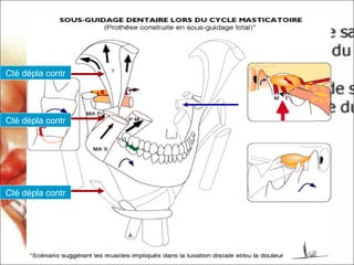 Cté dépla contr
Cté dépla contr
Cté dépla contr
 