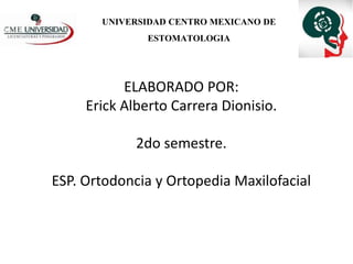 ELABORADO POR:
Erick Alberto Carrera Dionisio.
2do semestre.
ESP. Ortodoncia y Ortopedia Maxilofacial
UNIVERSIDAD CENTRO MEXICANO DE
ESTOMATOLOGIA
 