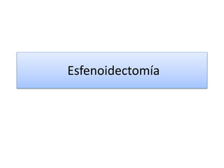 Esfenoidectomía
 
