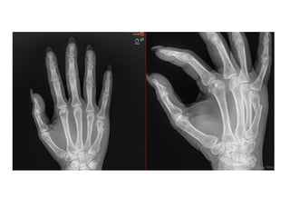 CENSO URGENCIAS ........................pptx