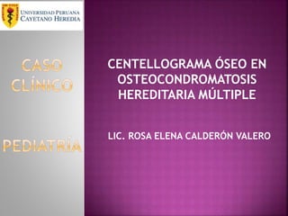 CENTELLOGRAMA ÓSEO EN
OSTEOCONDROMATOSIS
HEREDITARIA MÚLTIPLE
LIC. ROSA ELENA CALDERÓN VALERO
 