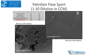 48 Hours (Pre-Wash)
48 Hours (Post-Wash)
PalinGen Flow Sport
(1:10 Dilution in CCM)
Flowable Amniotic Product Cells Present? Culture Expandable?
Amniofix Injectable No No
BioD Restore No No
FloGraft Freedom No No
Ovation Cellular Repair Matrix Yes No
PalinGen Sport Flow No No
 