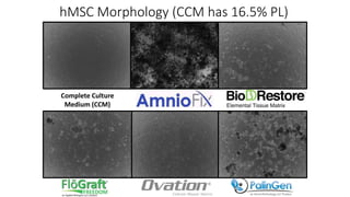 Complete Culture
Medium (CCM)
hMSC Morphology (CCM has 16.5% PL)
 