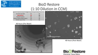 48 Hours (Pre-Wash)
48 Hours (Post-Wash)
BioD Restore
(1:10 Dilution in CCM)
Flowable Amniotic Product Cells Present? Culture Expandable?
Amniofix Injectable No No
BioD Restore No No
FloGraft Freedom No No
Ovation Cellular Repair Matrix Yes No
PalinGen Sport Flow No No
 