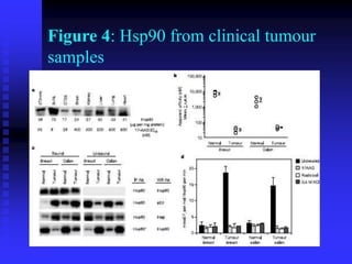 Figure 4: Hsp90 from clinical tumour
samples
 