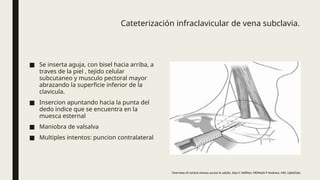 Musulo Bisel Colocacion . de cateter CENTRAL 2021.pptx