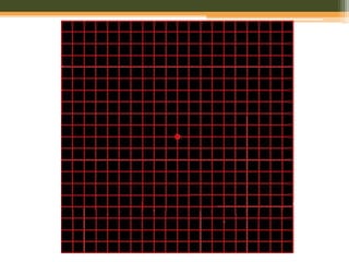 Central and peripheral visual field | PPTX