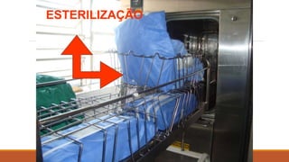 ESTERILIZAÇÃO
 