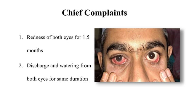 A 27-year-old male with bilateral red eyes.pptx