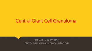 Central Giant Cell Granuloma
DR AMITHA . G, BDS, MDS
DEPT OF ORAL AND MAXILLOFACIAL PATHOLOGY
 