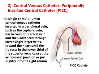 2) Central Venous Catheter: Peripherally
Inserted Central Catheter (PICC)
• A single or multi-lumen
central venous catheter
inserted in a peripheral vein,
such as the cephalic vein,
basilic vein or brachial vein
and then advanced through
increasingly larger veins,
toward the heart until the
tip rests in the lower third of
the superior vena cava at the
artrio-caval junction or just
slightly into the right atrium.
 