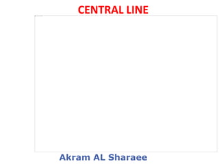 Akram AL Sharaee
CENTRAL LINE
 