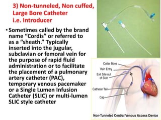 Tac Line Non Tunneled Catheter