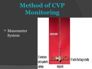 Comprehensive Guide to Cardiac Physiology and Hemodynamic Monitoring in ...