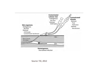 patient safety initiatives can be found in Chapter 4.
Chapter 3 contains a comprehensive review of the recom-
mended strategies and techniques for preventing CLABSIs.
route has been associated with more prolonged CVC
dwell time (for example, in place for more than 10
days), including tunneled CVCs such as Hickman-
and Broviac-type catheters and PICCs.
Figure 1-1. Routes for Central Venous Catheter Contamination with
Microorganisms
Potential sources of infection of a percutaneous intravascular device (IVD): the contiguous skin flora, contamination of the
catheter hub and lumen, contamination of infusate, and hematogenous colonization of the IVD from distant, unrelated sites of
infection. HCW: health care worker.
Source: Crnich CJ, Maki DG. The promise of novel technology for the prevention of intravascular device-related bloodstream infection. I.
Pathogenesis and short-term devices. Clin Infect Dis. 2002 May 1;34(9):1232–1242. Used with permission.
Source:	
  TJC,	
  2012	
  
 