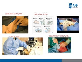CONFIRM ANATOMY HAND WASHING
USG GUIDED INSERTING GUIDE WIRE
 