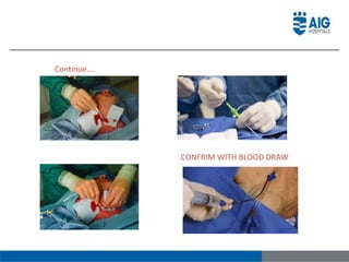 Continue….
CONFRIM WITH BLOOD DRAW
 