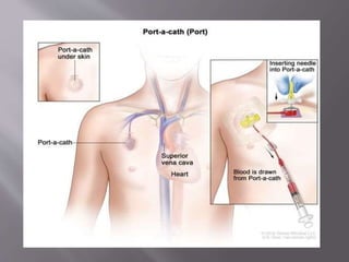 CENTRAL LINE INSERTION AND CARE.pptx