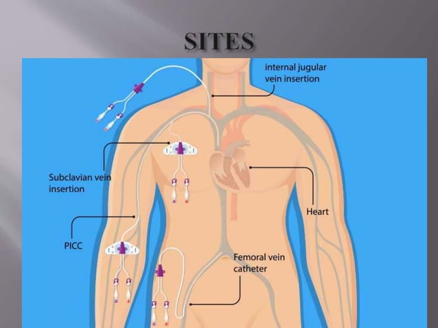 Center Line Insertion CENTRAL LINE INSERTION AND CARE.pptx