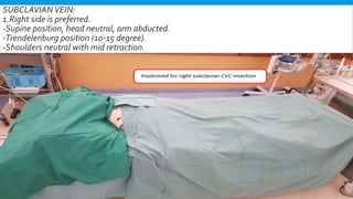 SUBCLAVIANVEIN:
1.Right side is preferred.
-Supine position, head neutral, arm abducted.
-Trendelenburg position (10-15 degree).
-Shoulders neutral with mid retraction.
 