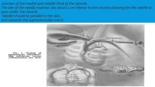 Junction of the medial and middle third of the clavicle.
The site of the needle insertion lies about 1 cm inferior to the clavicle allowing for the needle to
pass under the clavicle.
Needle should be parallel to the skin.
Aim towards the supraclavicular notch.
 