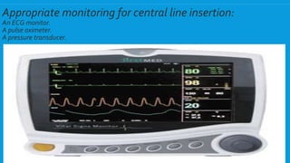 Appropriate monitoring for central line insertion:
An ECG monitor.
A pulse oximeter.
A pressure transducer.
 