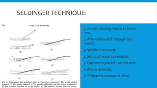 SELDINGERTECHNIQUE:
 1.Use introducing needle to locate
vein.
 2.Wire is threaded through the
needle.
 3.Needle is removed.
 4.Skin and vessel are dilated.
 5.Catheter is placed over the wire.
 6.Wire is removed.
 7.Catheter is secured in place.
 