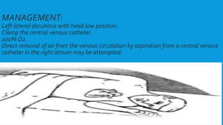 MANAGEMENT:
Left lateral decubitus with head low position.
Clamp the central venous catheter.
100% O2.
Direct removal of air from the venous circulation by aspiration from a central venous
catheter in the right atrium may be attempted.
 