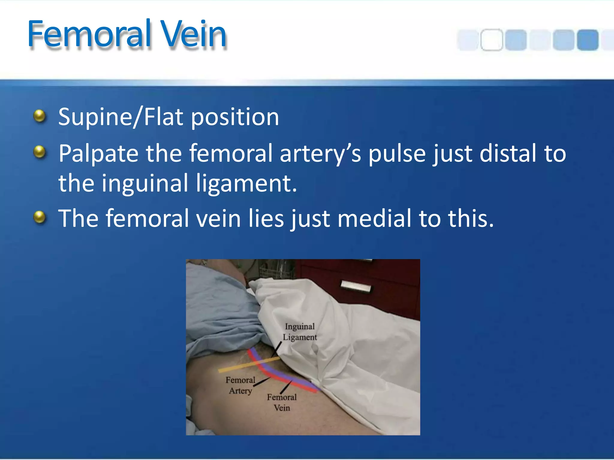 Femoral Vein
Supine/Flat position
Palpate the femoral artery’s pulse just distal to
the inguinal ligament.
The femoral vein lies just medial to this.
 