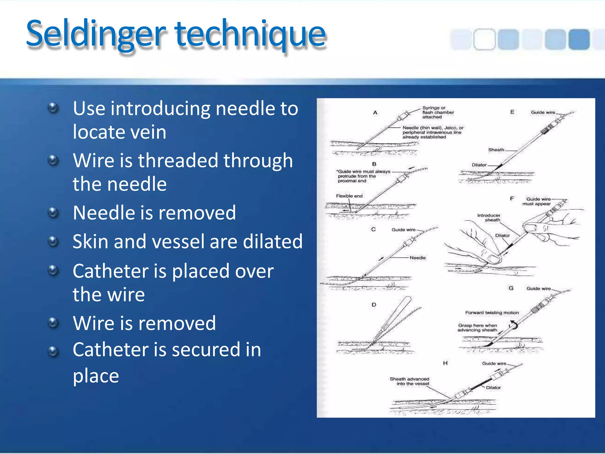 Seldinger technique
Use introducing needle to
locate vein
Wire is threaded through
the needle
Needle is removed
Skin and vessel are dilated
Catheter is placed over
the wire
Wire is removed
Catheter is secured in
place
 