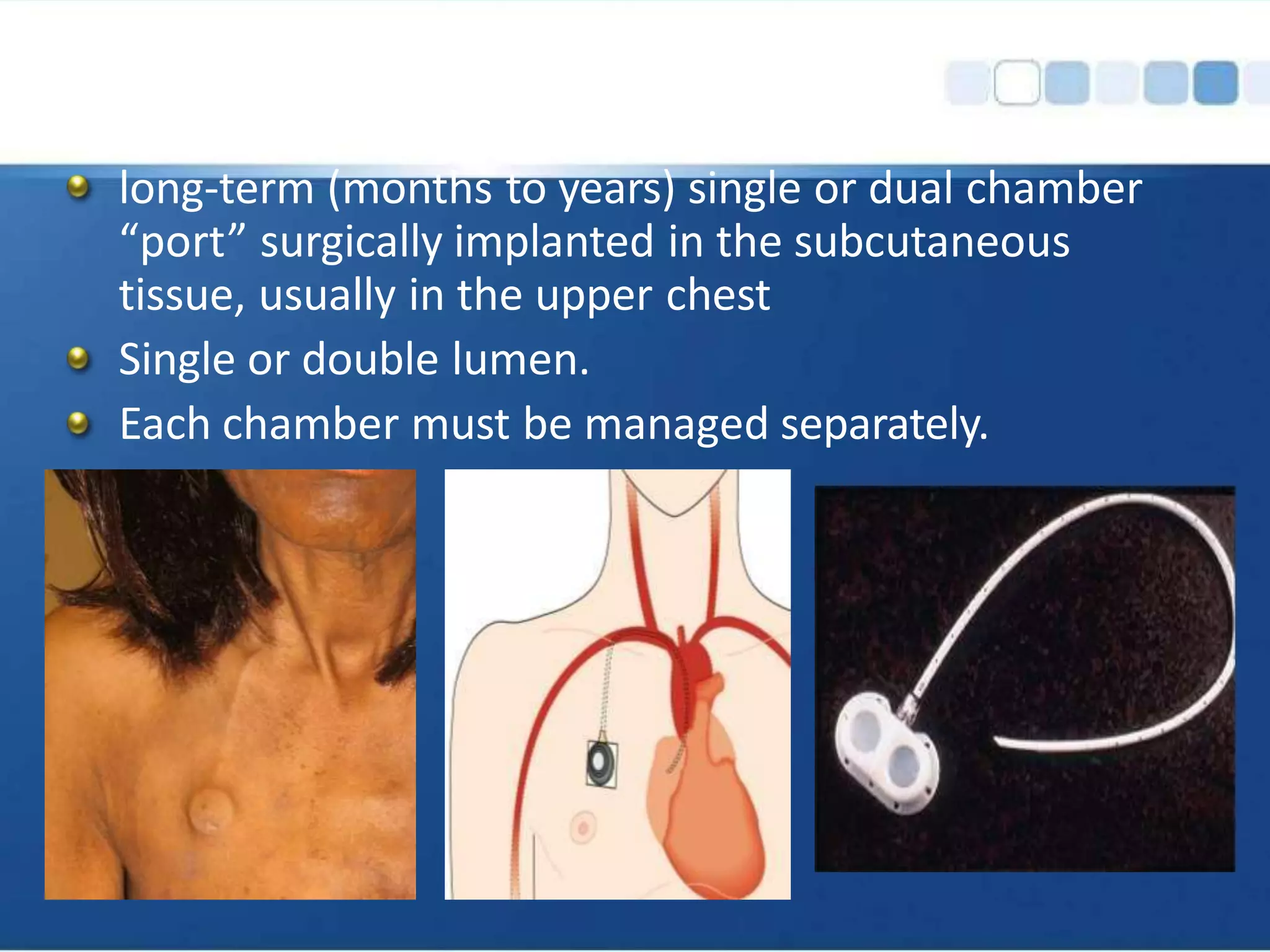 long-term (months to years) single or dual chamber
“port” surgically implanted in the subcutaneous
tissue, usually in the upper chest
Single or double lumen.
Each chamber must be managed separately.
 