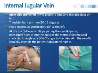 Internal Jugular Vein
Right side preferred-lower pleural dome and thoracic duct on
left
Trendelenburg position(10-15 degrees)
Head rotated approximately 150 to the left
At the cricoid level while palpating the carotid pulse,
introducer needle into the apex of the sternocleidomastoid-
clavicular triangle at a 30-400 angle to the skin. Aim the needle
caudally towards the patient’s ipsilateral nipple.
 