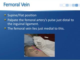 Femoral Vein
Supine/Flat position
Palpate the femoral artery’s pulse just distal to
the inguinal ligament.
The femoral vein lies just medial to this.
 